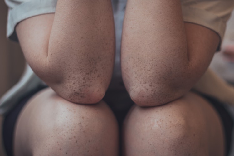 Adolescente assise avec des genoux croisés